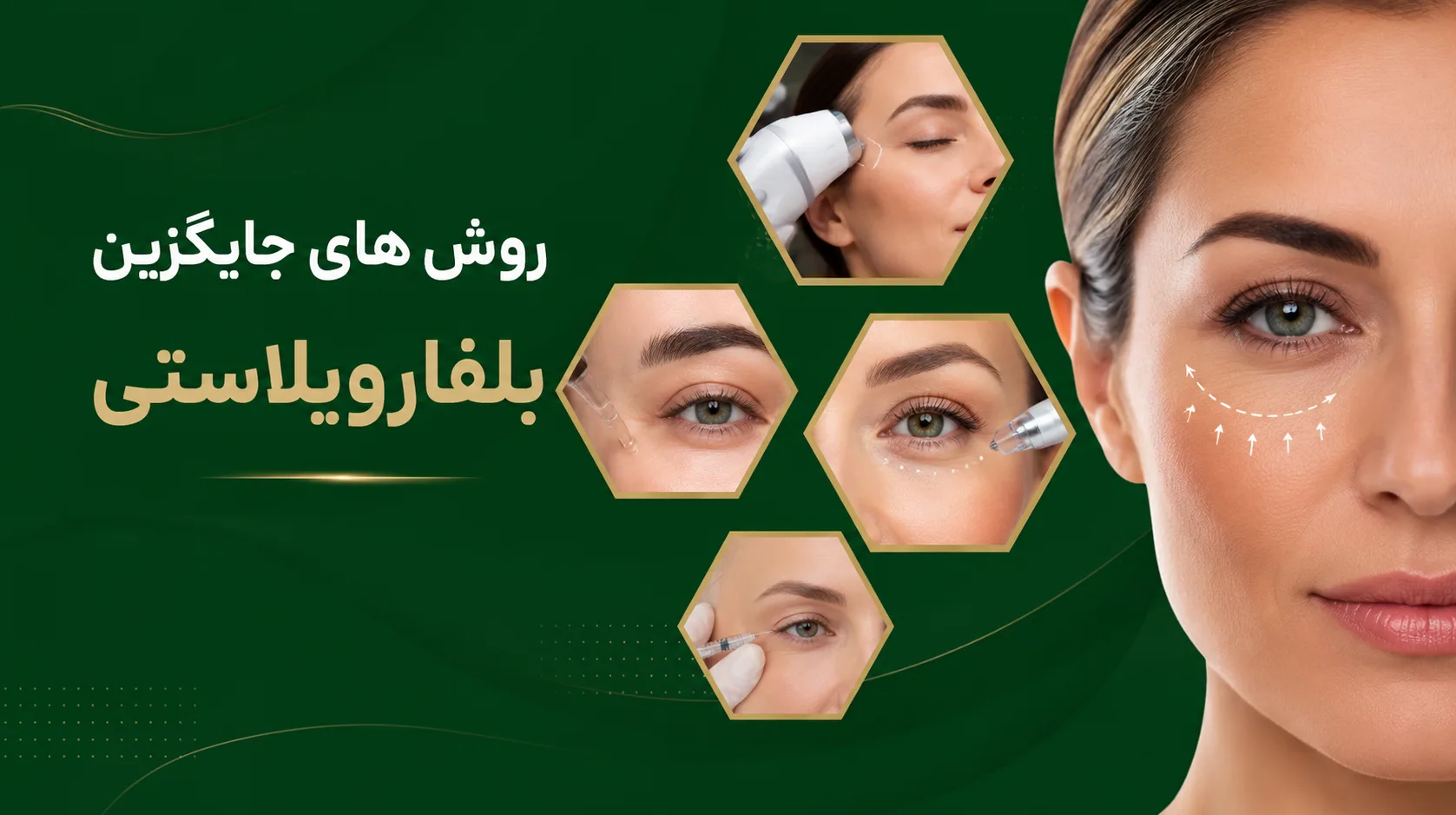 روش های جایگزین بلفاروپلاستی